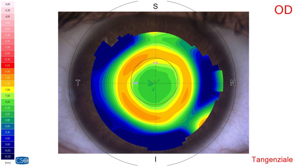 Topografia Trattamento Ortocheratologico - Ottica Pansarini